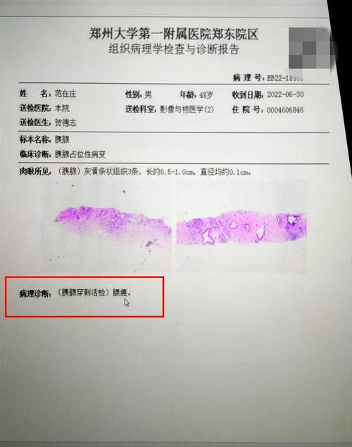 新澳门开奖记录和为全家做饭确诊肺癌与为全家做饭确诊肺癌的人
