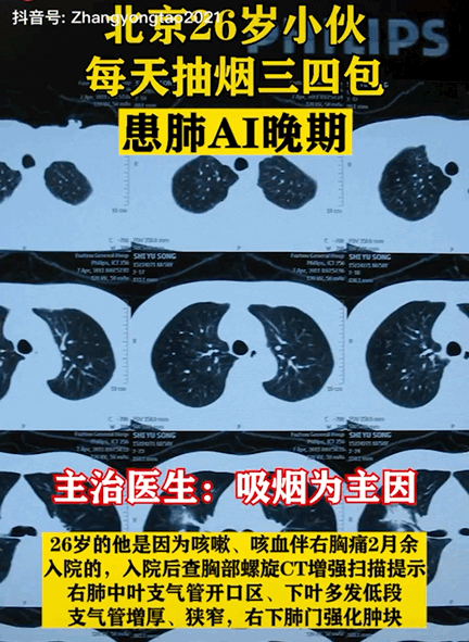 新澳门彩最快开奖记录和吸烟如何摧毁你的肺与吸烟如何损害肺部